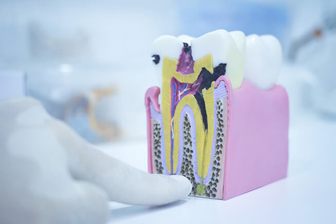 Pós Graduação em Endodontia (Profa. Cristiane Bonanato Estrela)